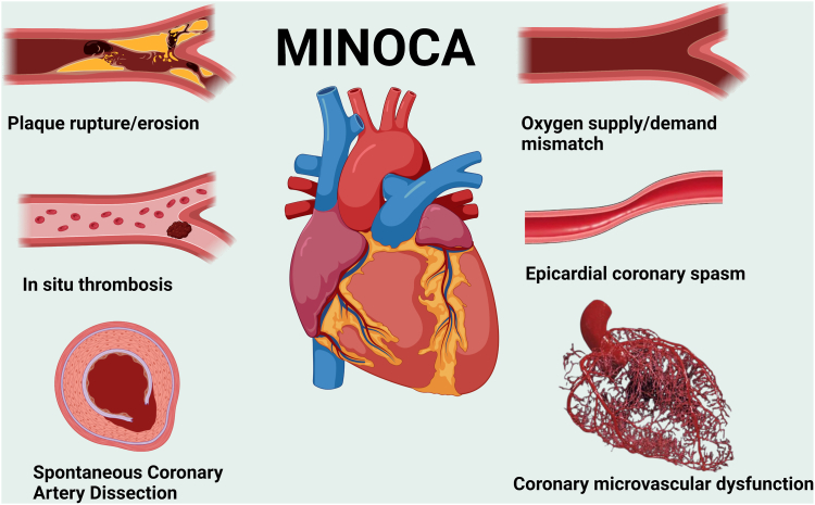 Figure 3