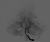 Figure 12.