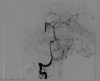 Figure 11.