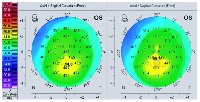 Figure 4