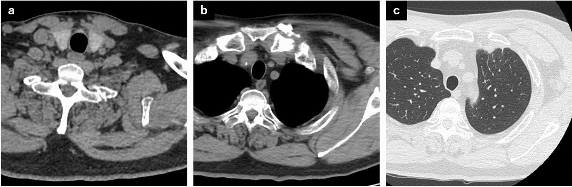 Fig. 3