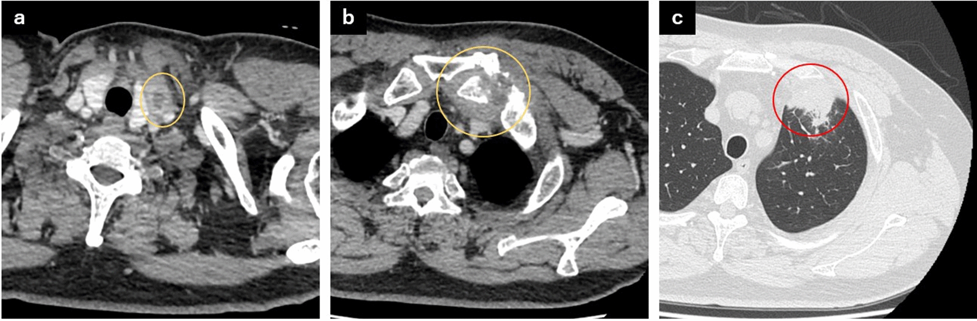 Fig. 1