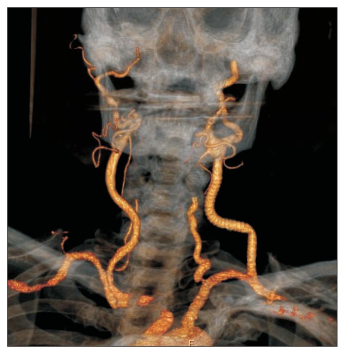 Fig. 3