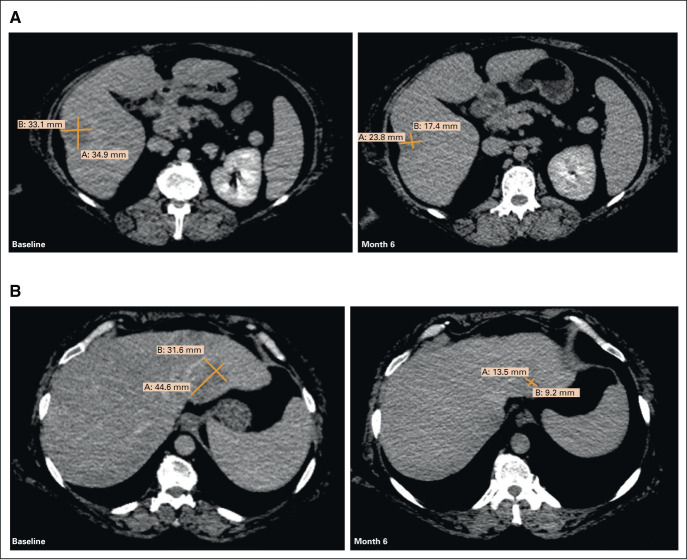 FIG 3.