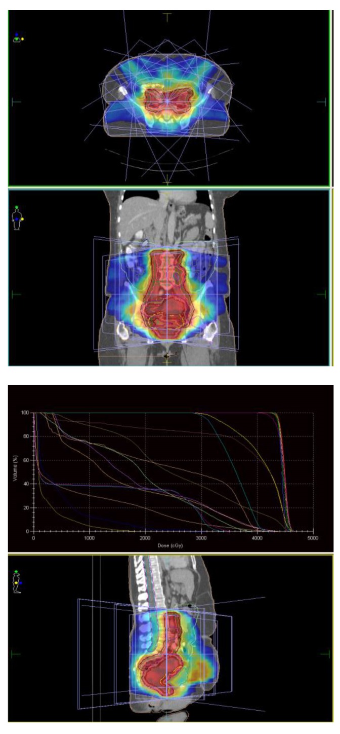 Fig. 3