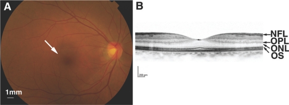 Fig. (2) The human retina.