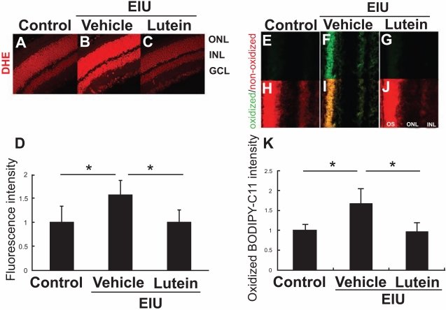 Fig. (3) Lutein’s effect on oxidative stress in the inflamed retina.