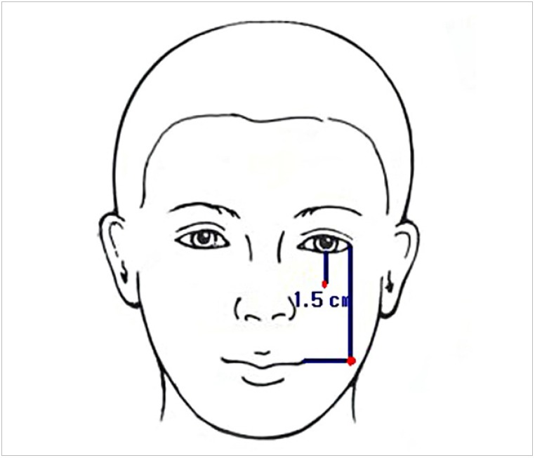 Fig. 2.