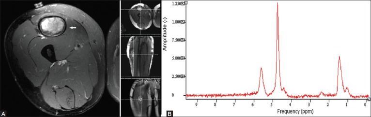 Figure 5 (A, B)