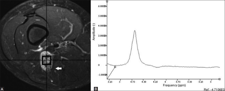 Figure 4 (A, B)