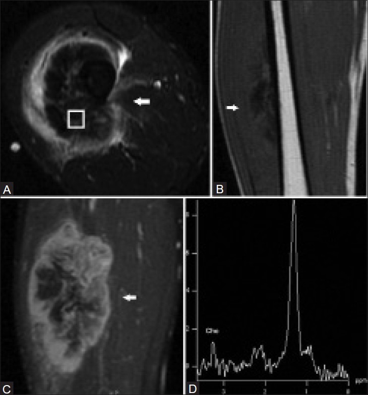 Figure 2 (A-D)