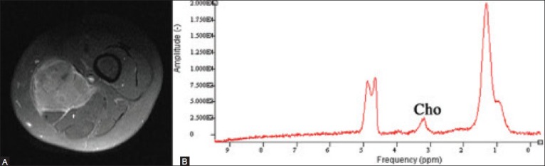 Figure 3 (A-B)