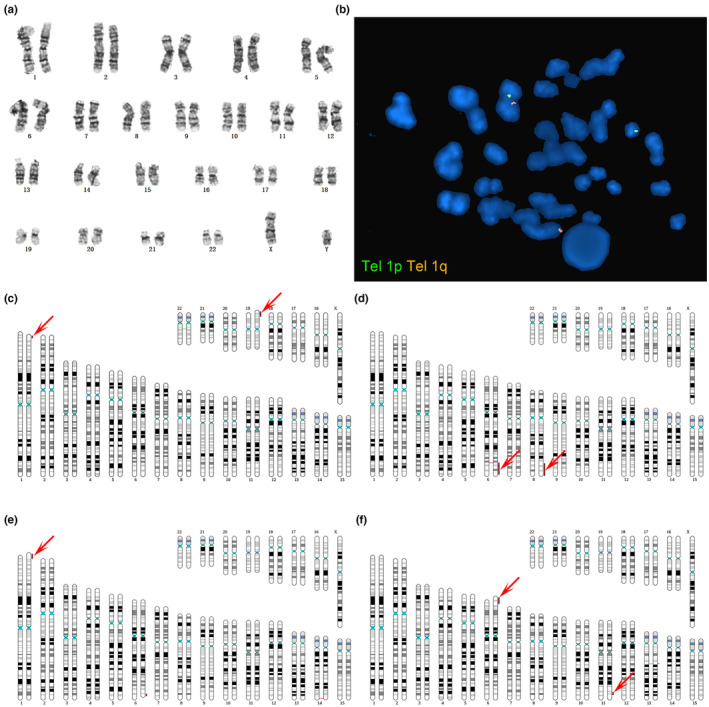 FIGURE 1