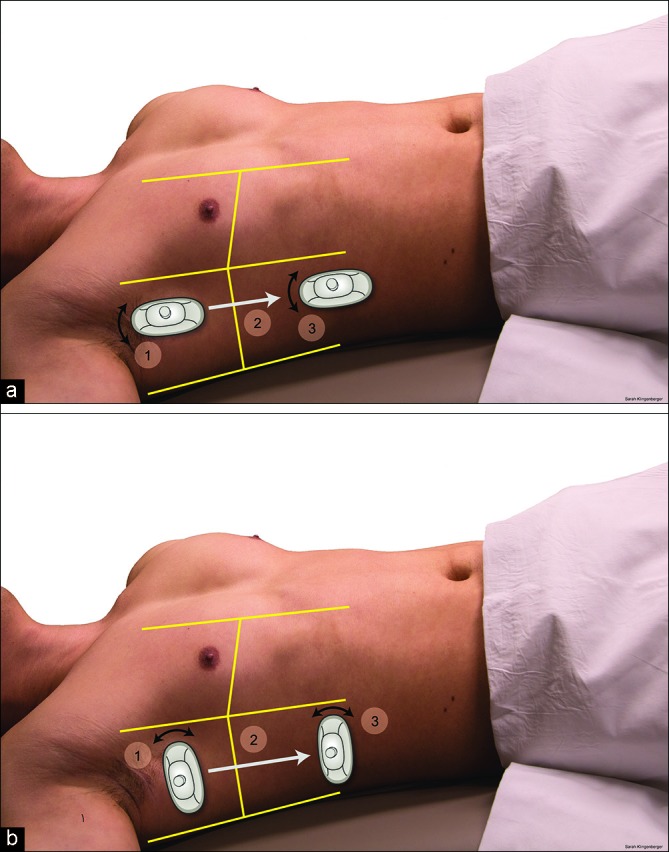 Figure 4: