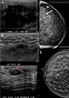 Fig 3