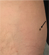 Fig 5
