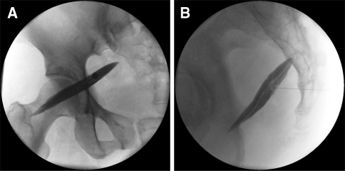 Fig. 4