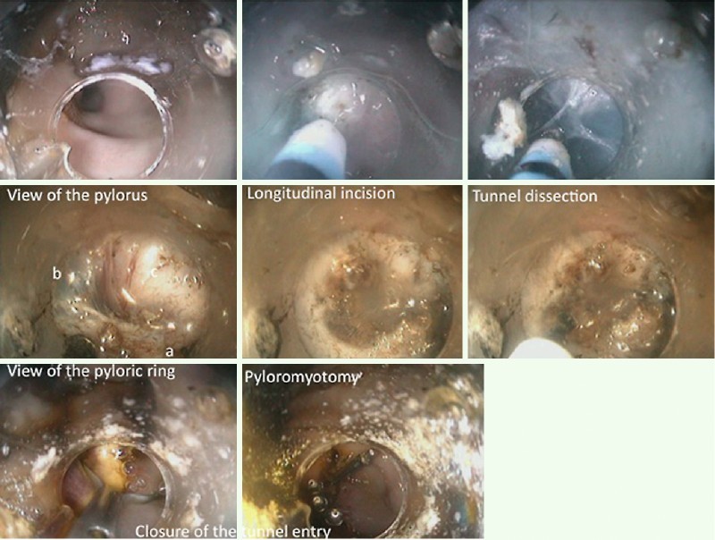 Fig. 1