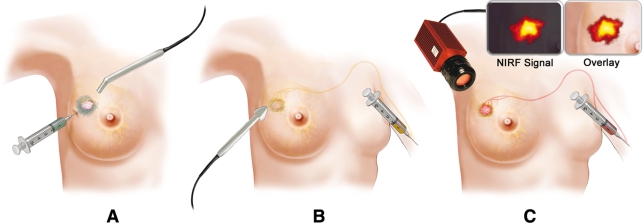 Fig. 1