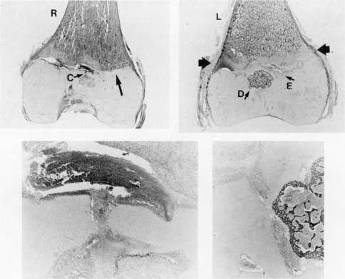 FIG. 11