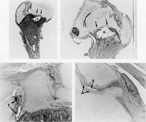 FIG. 10