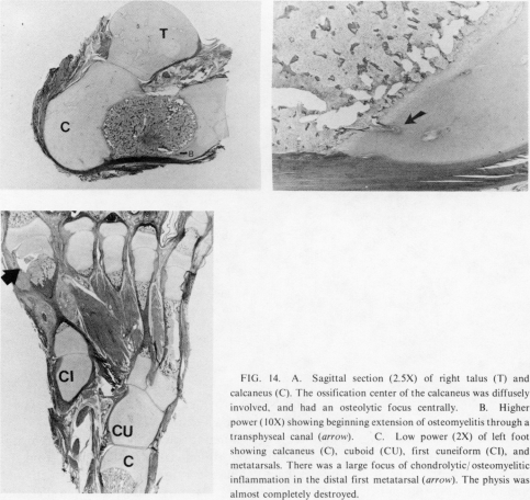 FIG. 14