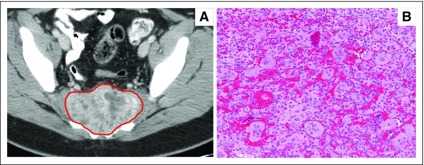 Fig 2.