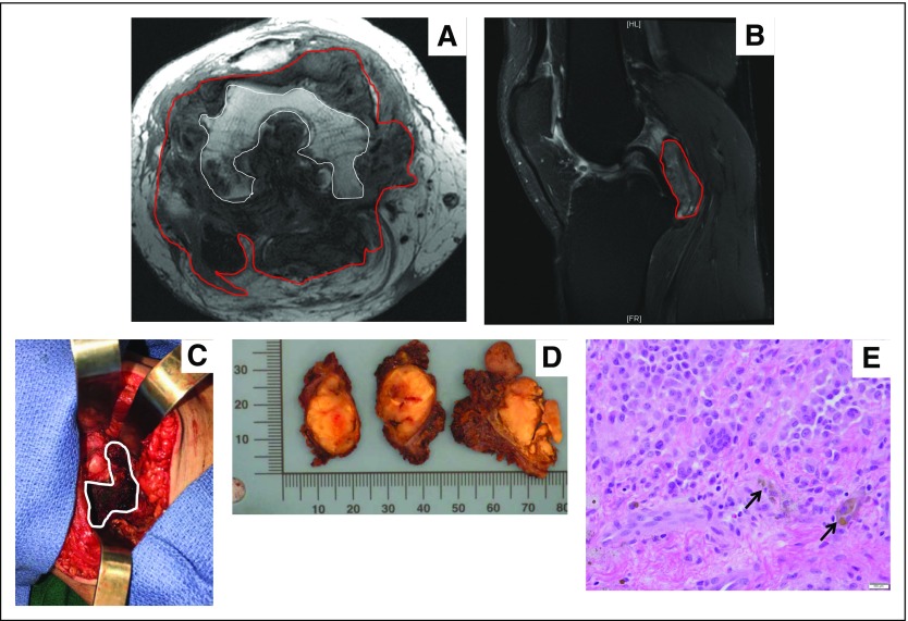 Fig 3.