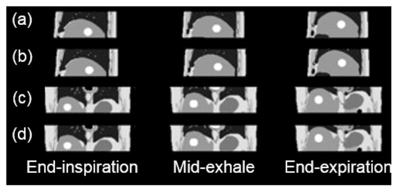 Fig. 13