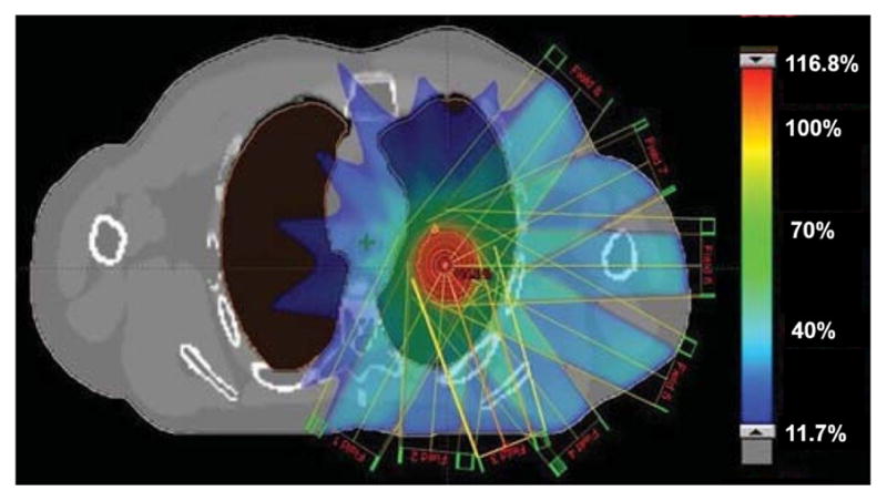 Fig. 12