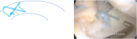 Fig 10