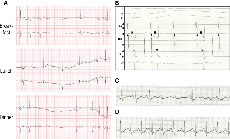 Figure 1