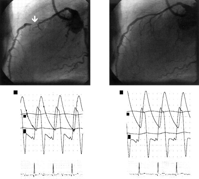 Figure 1  