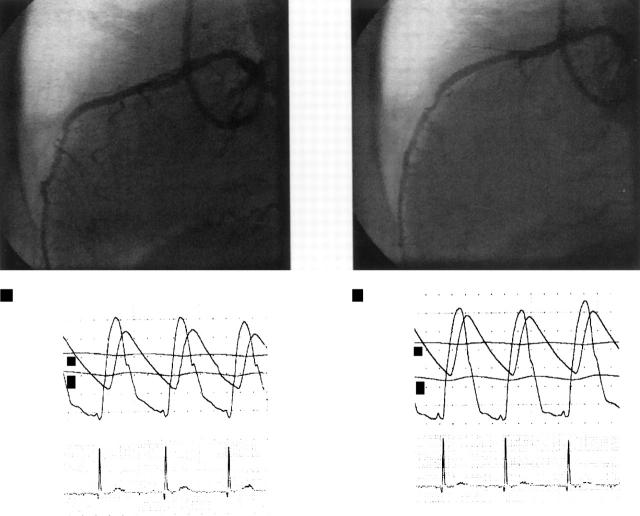 Figure 2  