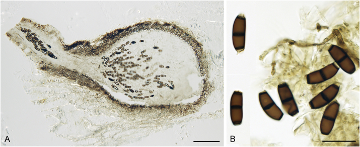 Fig. 18