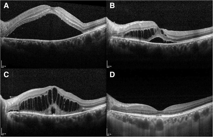 Fig. 3