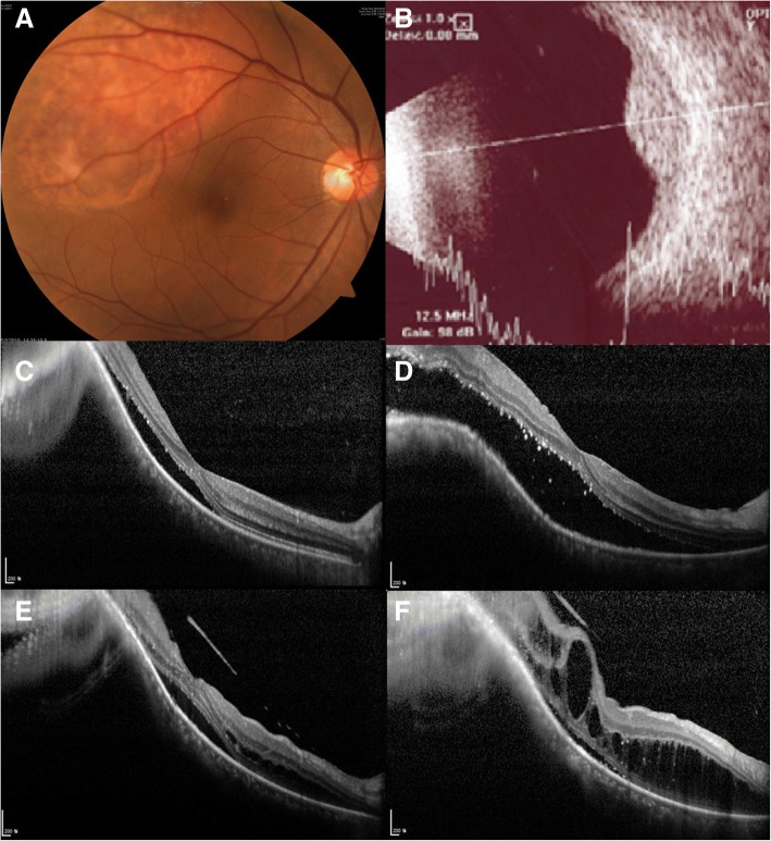 Fig. 2