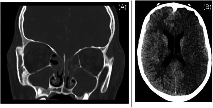 FIGURE 9