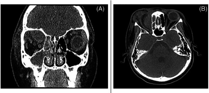 FIGURE 3