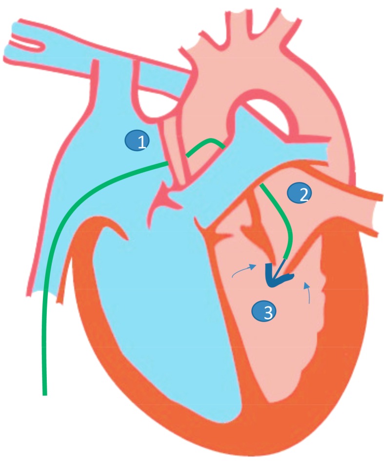 Fig. (3)