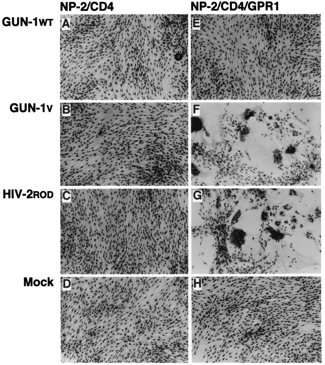 FIG. 4