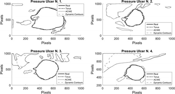 Fig. 16