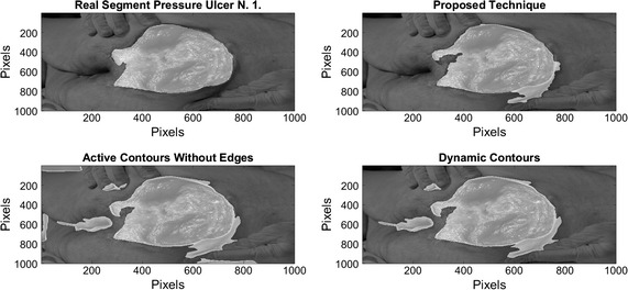 Fig. 12