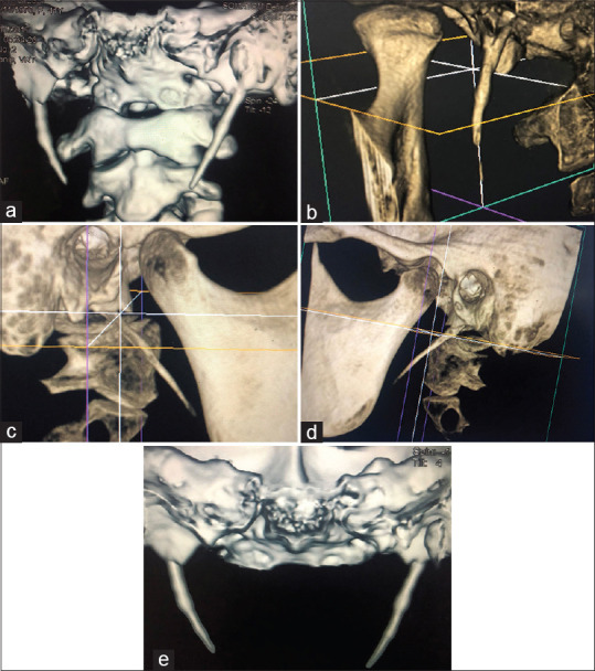 Figure 13