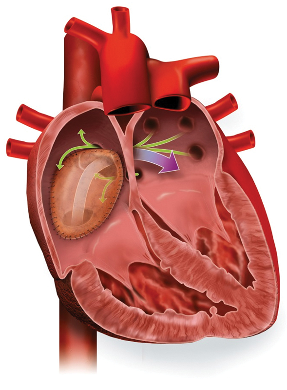 Fig. 6