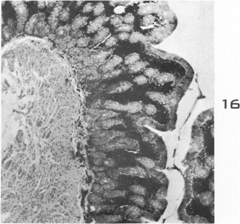 Fig. 16