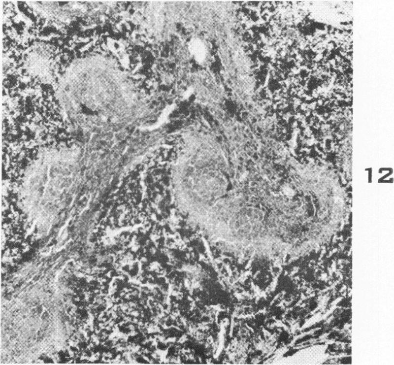 Fig. 12