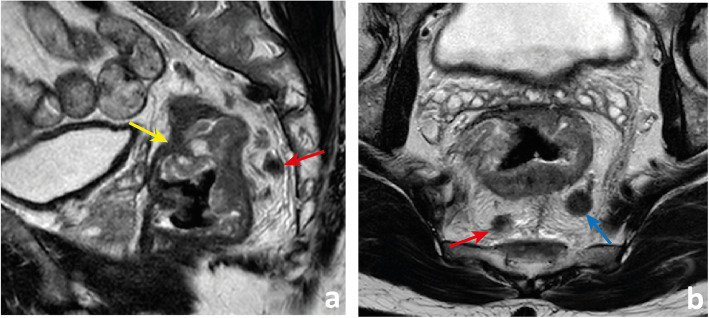 Fig. 16