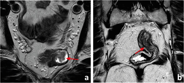 Fig. 18