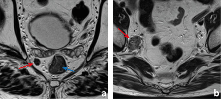 Fig. 15 